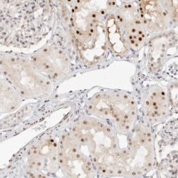 HIPK3 Antibody, Novus Biologicals:Antibodies:Primary Antibodies