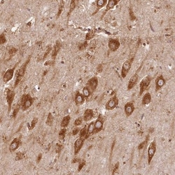 HISPPD1 Antibody, Novus Biologicals 25 &mu;L, Unlabeled:Antibodies, Polyclonal
