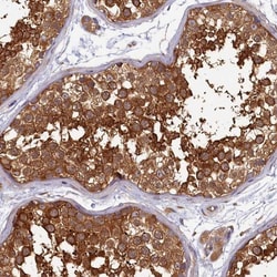 HISPPD2A Antibody, Novus Biologicals 0.1mL; Unlabeled:Antibodies, Polyclonal