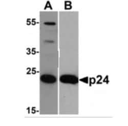 HIV-1 Gag p24 Antibody (8G9) - BSA Free, Novus Biologicals 0.025 mg, Unlabeled:Antibodies,