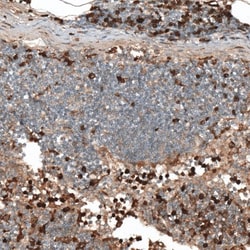 HJURP Antibody, Novus Biologicals 0.1mL; Unlabeled:Antibodies, Polyclonal