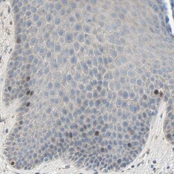 HJURP Antibody, Novus Biologicals 0.1mL; Unlabeled:Antibodies, Polyclonal