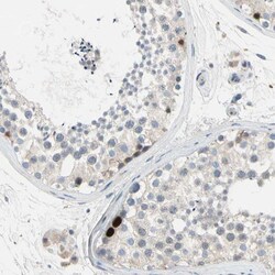 HJURP Antibody, Novus Biologicals 0.1mL; Unlabeled:Antibodies, Polyclonal