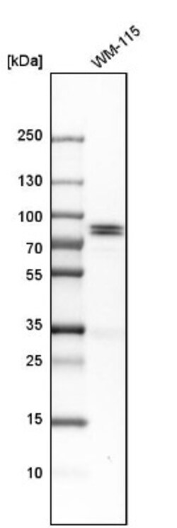 HJURP Antibody, Novus Biologicals 0.1mL; Unlabeled:Antibodies, Polyclonal