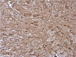 HKDC1 Antibody, Novus Biologicals 0.1mL:Antibodies, Polyclonal