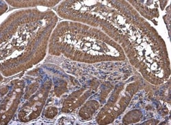 HKDC1 Antibody, Novus Biologicals 0.1mL:Antibodies, Polyclonal