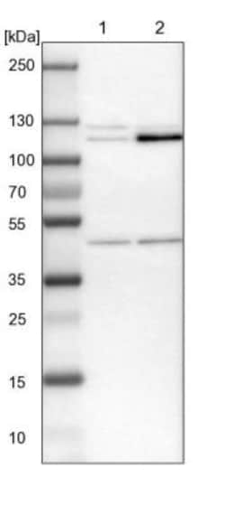 HKDC1 Antibody, Novus Biologicals:Antibodies:Primary Antibodies