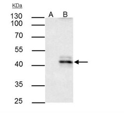 HLA A Antibody, Novus Biologicals 0.1mL; Unlabeled:Antibodies, Polyclonal