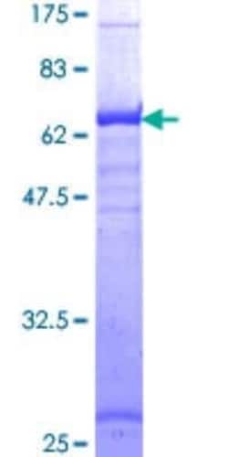 Novus Biologicals Recombinant Human HLA A GST (N-Term) Protein 2 &mu;g | Buy Online | Novus Biologicals&trade; | Fisher Scientific