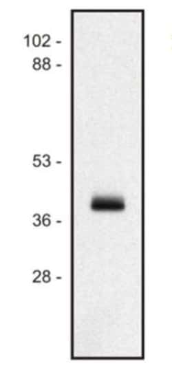 HLA Class I Antibody (MEM-147) - BSA Free, Novus Biologicals 0.1mg; Unlabeled:Antibodies,