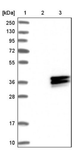 HLA DMA Antibody, Novus Biologicals 0.1mL; Unlabeled:Antibodies, Polyclonal