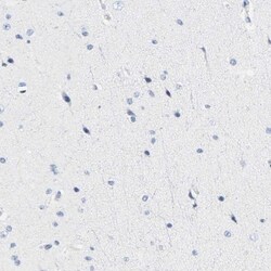 HLA DOB Antibody, Novus Biologicals 0.1mL; Unlabeled:Antibodies, Polyclonal