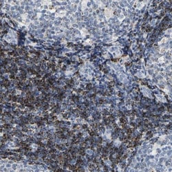 HLA DOB Antibody, Novus Biologicals 0.1mL; Unlabeled:Antibodies, Polyclonal
