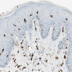 HLA DPB1 Antibody, Novus Biologicals 25 &mu;L; Unlabeled:Antibodies, Polyclonal