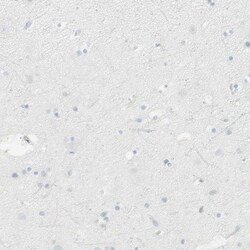 HLA DPB1 Antibody, Novus Biologicals 25 &mu;L; Unlabeled:Antibodies, Polyclonal