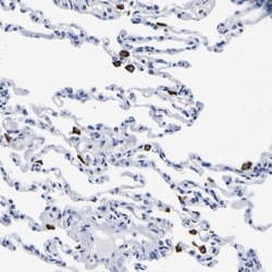 HLA DQA1 Antibody, Novus Biologicals 0.1mL; Unlabeled:Antibodies, Polyclonal