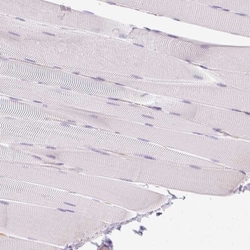 HLA DRA Antibody, Novus Biologicals 0.1 mL | Buy Online | Novus Biologicals | Fisher Scientific