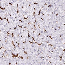 HLA DRA Antibody, Novus Biologicals 0.1mL; Unlabeled:Antibodies, Polyclonal