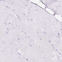 HLA DRA Antibody, Novus Biologicals 0.1mL; Unlabeled:Antibodies, Polyclonal