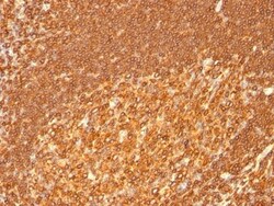 HLA DRB1 Antibody (HLA-DRB/1067), Novus Biologicals 0.2mg; Unlabeled:Antibodies,