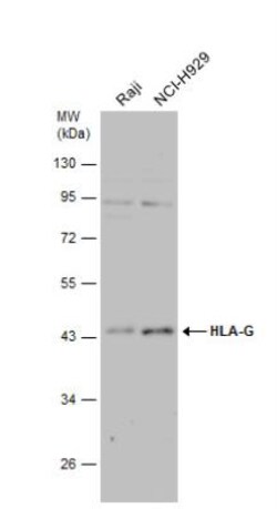 HLA G Antibody, Novus Biologicals 0.1mL; Unlabeled:Antibodies, Polyclonal
