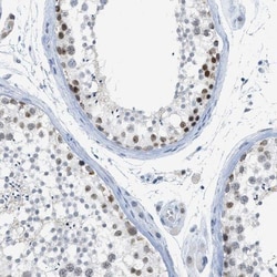 HLTF Antibody, Novus Biologicals 0.1mL; Unlabeled:Antibodies, Polyclonal