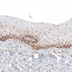 HLTF Antibody, Novus Biologicals 0.1mL; Unlabeled:Antibodies, Polyclonal