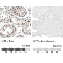 HLTF Antibody, Novus Biologicals 0.1mL; Unlabeled:Antibodies, Polyclonal