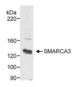 HLTF Antibody, Novus Biologicals 0.1mL; Unlabeled:Antibodies, Polyclonal