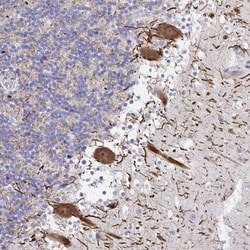 HMBOX1 Antibody, Novus Biologicals:Antibodies:Primary Antibodies