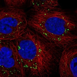 HMBS Antibody, Novus Biologicals:Antibodies:Primary Antibodies
