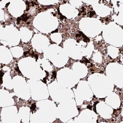 HMBS Antibody, Novus Biologicals:Antibodies:Primary Antibodies