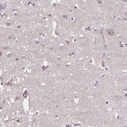 HMBS Antibody, Novus Biologicals:Antibodies:Primary Antibodies