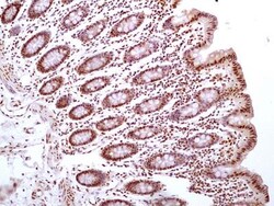 HMGB1/HMG-1 Antibody (19N10B7) - BSA Free, Novus Biologicals 0.025mg; Unlabeled:Antibodies,