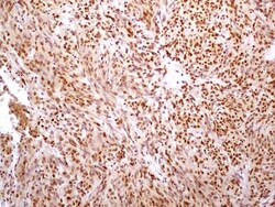 HMGB1/HMG-1 Antibody (19N10B7) - BSA Free, Novus Biologicals 0.025mg; Unlabeled:Antibodies,