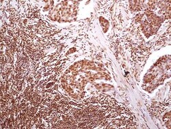 HMGB1/HMG-1 Antibody (19N10B7) - BSA Free, Novus Biologicals 0.025mg; Unlabeled:Antibodies,
