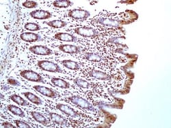 HMGB1/HMG-1 Antibody (19N15F4), Novus Biologicals 0.1mg; Unlabeled:Antibodies,