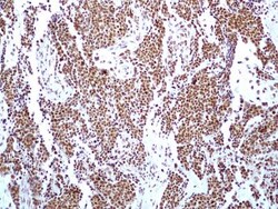HMGB1/HMG-1 Antibody (19N15F4), Novus Biologicals 0.1mg; Unlabeled:Antibodies,