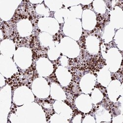 HMGB2 Antibody, Novus Biologicals 0.1mL; Unlabeled:Antibodies, Polyclonal