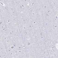 HMGB2 Antibody, Novus Biologicals 0.1mL; Unlabeled:Antibodies, Polyclonal
