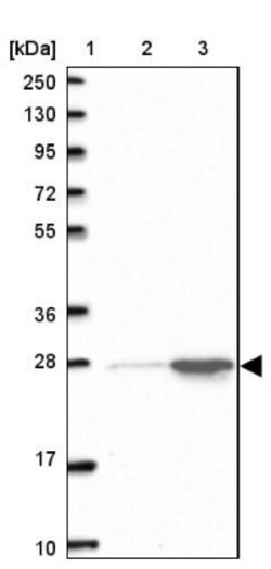 HMGB2 Antibody, Novus Biologicals 0.1mL; Unlabeled:Antibodies, Polyclonal
