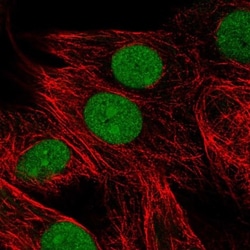 HMGB3/HMG4 Antibody, Novus Biologicals 25 &mu;L; Unlabeled:Antibodies,