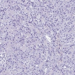 HMGB3/HMG4 Antibody, Novus Biologicals 25 &mu;L; Unlabeled:Antibodies,