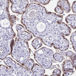 HMGB3/HMG4 Antibody, Novus Biologicals 25 &mu;L; Unlabeled:Antibodies,