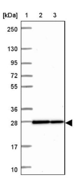 HMGB3/HMG4 Antibody, Novus Biologicals 25 &mu;L; Unlabeled:Antibodies,