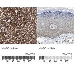 HMGCL Antibody, Novus Biologicals:Antibodies:Primary Antibodies