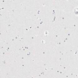 HMGCS2 Antibody, Novus Biologicals 25 &mu;L, Unlabeled:Antibodies, Polyclonal