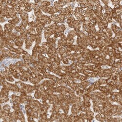 HMGCS2 Antibody, Novus Biologicals 25 &mu;L, Unlabeled:Antibodies, Polyclonal