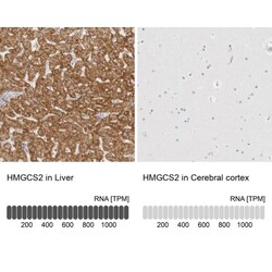 HMGCS2 Antibody, Novus Biologicals 25 &mu;L, Unlabeled:Antibodies, Polyclonal