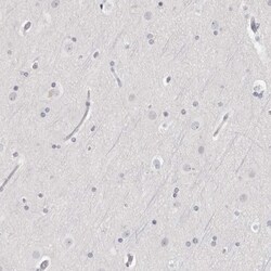 HMGCS2 Antibody, Novus Biologicals 0.1mL; Unlabeled:Antibodies, Polyclonal